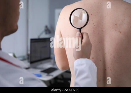 Männlicher Arzt Blick auf die Lupe auf der Haut des Patienten Stockfoto