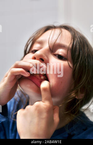 10 Jahre alte Junge seinen Wackeligen Zahn prüfen. Stockfoto