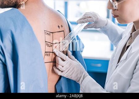 7/8-Ansicht von allergist Holding Herrscher in der Nähe von Mann mit Zurück gekennzeichnet Stockfoto