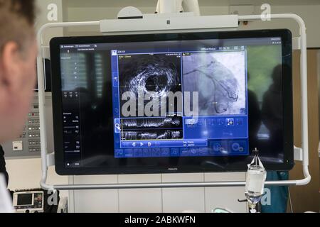 Kardiologie Chefarzt Stefan Sack zeigt die Angiographie Plattform 'Azurion' im Herzkatheterlabor der städtischen Klinik Neuperlach. [Automatisierte Übersetzung] Stockfoto