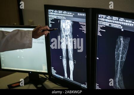 Radiologie Chefarzt Andrea Rieber-Brambs in der Berichterstattung über die Bilder der neuen Kernspintomographen (MRT) "ingenia Ehrgeiz" in der radiologischen Abteilung der städtischen Klinik Neuperlach. [Automatisierte Übersetzung] Stockfoto