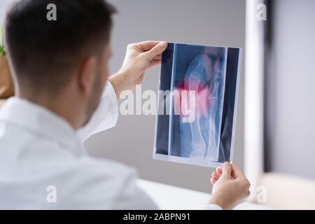 In der Nähe von einem männlichen Arzt Hand, die Füße X-ray Stockfoto