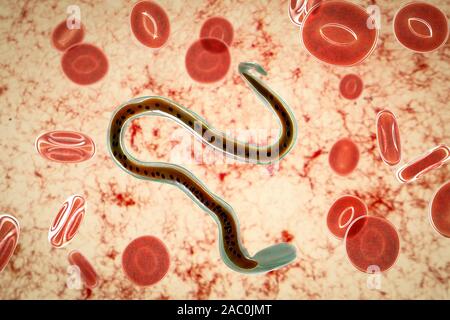 Wuchereria bancrofti Parasiten, Abbildung Stockfoto