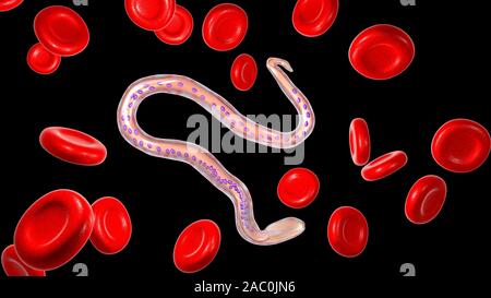 Wuchereria bancrofti Parasiten, Abbildung Stockfoto