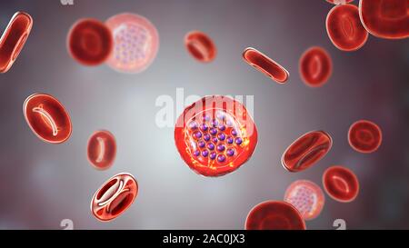 Protozoan Plasmodium falciparum in der Phase der schizont, Il Stockfoto