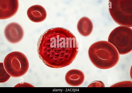 Protozoan Plasmodium falciparum in der Phase der schizont, Il Stockfoto