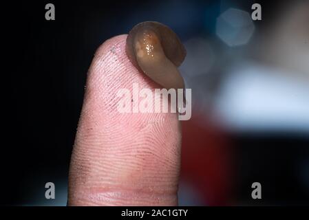 Ein wenig Schleim auf eine schmutzige Finger, close-up. Stockfoto