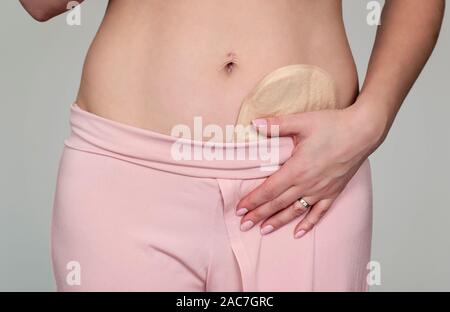 Vorderansicht auf colostomy Pouch an Frau Patienten in den Hosen in der Nähe versteckt, medizinische Thema. Darmkrebs Chirurgie Behandlung. Stockfoto