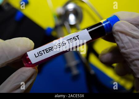 Listeriose Prüfen Sie den Text mit Blutprobe. Draufsicht auf Büro Schreibtisch Hintergrund isoliert. Healthcare/Medical Konzept Stockfoto
