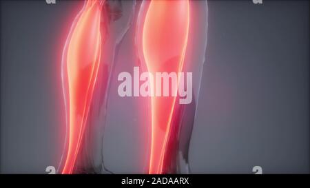 Gastrocnemius - Sichtbare Muskel Anatomie Karte Stockfoto