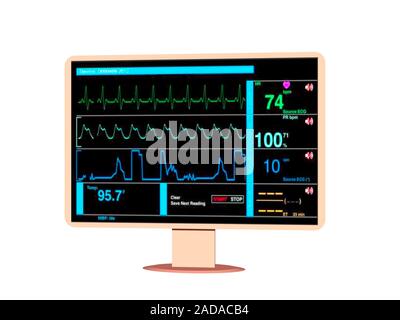 Monitor zur Überwachung der Vitalparameter im Krankenhaus Stockfoto