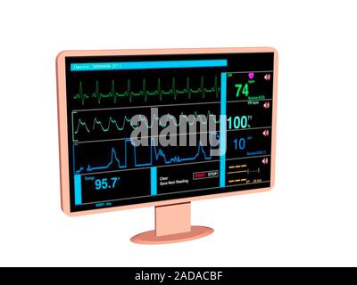 Monitor zur Überwachung der Vitalparameter im Krankenhaus Stockfoto