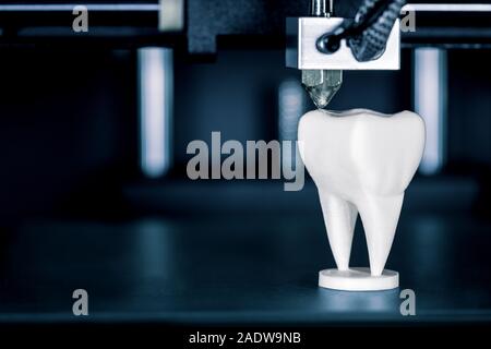 Mit einem 3D-Drucker in der Zahnheilkunde, Zahnersatz sind durch abgesicherte filament Herstellung gemacht Stockfoto