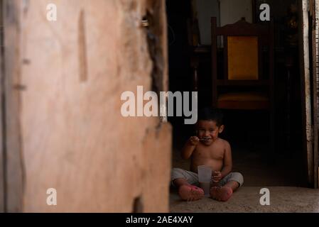 Caracas, Miranda, Venezuela. 29 Nov, 2019. Eine große Krise geschieht in dem südamerikanischen Land von Venezuela. Eine korrupte Regierung und massive Inflation hat einen erheblichen Mangel im Gesundheitswesen verursacht. Die in armen Slums sind stark leiden. Einige NGOS, die versuchen, so viel wie möglich zu helfen. Eine solche NGO ist Impronta Venezuela. Impronta ist eine venezuelanische gemeinnützige Organisation, mit dem Ziel der Umgestaltung der Wirklichkeit, die uns Herausforderungen geboren wurde, Möglichkeiten für die am stärksten gefährdeten Bevölkerungsgruppen ihr maximales Potenzial zu erreichen, im Bündnis mit öffentlichen und privaten Institutio Stockfoto