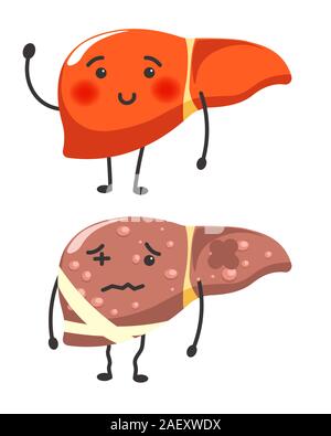 Gesunde vs kranken Leber menschliche Organ Gesundheit Vergleich Stock Vektor