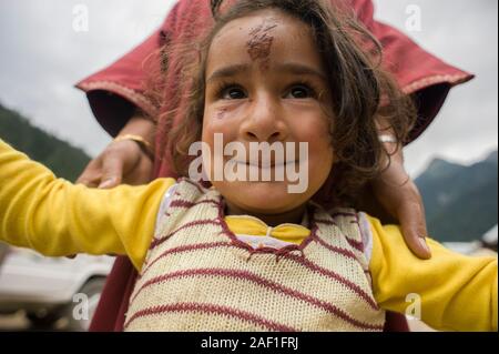 Pahalgam, Jammu und Kashmir, Indien - 02. August 2011: Kleines und glückliches Kaschmir-Mädchen mit einer riesigen Wunde an der Stirn Stockfoto