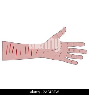 Männliche hand mit blutigen Schnitte am Handgelenk nach Selbstmordversuch. Isolierte cartoon Vektor illustration Stock Vektor