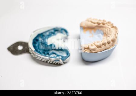 Künstliche Gips Spannbacken mit Eindruck auf den weißen Hintergrund. Herstellung von Formen für Zahnersatz im Labor Stockfoto