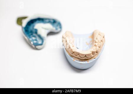 Künstliche Gips Spannbacken mit Eindruck auf den weißen Hintergrund. Herstellung von Formen für Zahnersatz im Labor Stockfoto
