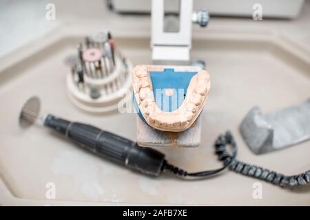 Künstliche Kiefer für Implantate Modellierung mit Dental Bohrer am Arbeitsplatz der Zahntechniker im Labor Stockfoto