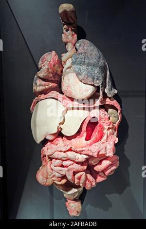 Präparat, Plastinat, innere Organe mit Raucherlunge, Lehrwerk Museum, Berlin, Deutschland Stockfoto