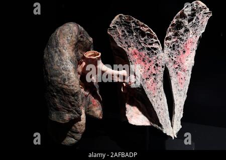 Präparat, Plastinat, Raucherlunge mit Lungenemphysem, Lehrwerk Museum, Berlin, Deutschland Stockfoto