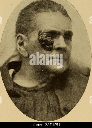 . Postoperative Behandlung; der Inbegriff der Geschäftsleitung der postoperativen Versorgung und Behandlung von chirurgischen Fällen, die von Prominenten Amerikanischen und Europäischen Chirurgen praktiziert. Abb. i6 = Abb. 166.. Stockfoto