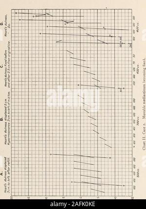 . Transaktionen der Amerikanischen klimatologische und klinische Assoziation.. Bewegliche MEDIASTINUM UND DAS MANOMETER 155. 156 CD. PARFITT die Effizienz von denen hört im umgekehrten Verhältnis zu den degreeof Spannungsgefühl. In jedem Fall, auch, der Druck wird durch Diebewegung die Ausdehnung der Lunge behandelt und einige Con-Fusion in der Auslegung können verursacht werden. Wie byHamman und Sloan, ein Re - erweitert Lungenkrebs wird durch eine verygradual Anstieg der Druck auf die Einführung jedes deciliter von Gas gezeigt, während eine Lunge kollabierte bleibt von einem langsamen riseat zuerst gezeigt wird, und dann Ein sehr plötzlicher und markierten r Stockfoto