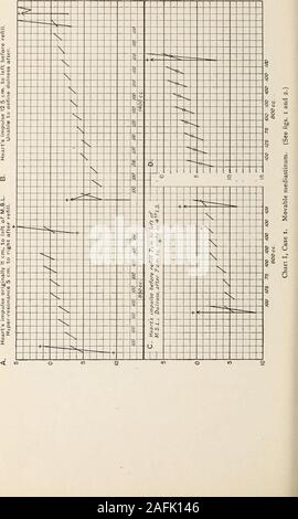 . Transaktionen der Amerikanischen klimatologische und klinische Assoziation.. auf ofgas den gegenüberliegenden intrapleural Spannungen zu erbringen. Über in-spiration wird es sein, aber wenig in Form geändert und wird sich deshalb nicht auf die Auswirkungen der Erweiterung der Pneumothorax Hohlraum Neutralisieren durch die Erweiterung der Brustwandseitigen und der Abstieg der Membran. Die respiratorymovement wird dann die expansionof stärker beeinflussen die eingestürzter Lungenflügel, aber gleichzeitig wird Es moremarked werden Inspiratorischer und exspiratorischer Druck vom Manometer erfasst. Die Amplitude wird daher größer sein. (Kontrast Stockfoto