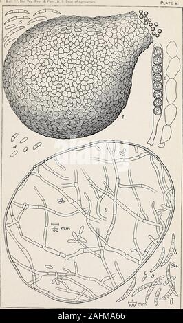 . Willst Krankheit aus Baumwolle, Wassermelonen und Cowpea (Neocosmospora nov. gen.)., die verwelkt und starb früh in der Saison. Viele Pflanzen betroffen waren. Die Stämme waren 2 Fuß hoch und ca. 1 cm Durchmesser an der Basis. Die woodwas viel gebräunt die gesamte Länge der Stammzellen. J. Macroconidia von externen Konidien Betten auf toten Okra 2: "lants. James Island.S. C, Juli 25,1895. Die reifen Sporen gemessenen 27 bis 42 durch 3 bis 5//. Occasionallyone war 5 septiert. Die Schiffe und Parenchym dieser Pflanzen enthielt eine greatamount der Myzel Lager wie Sporen, wie in 4 gezeigt werden. 6. Hochvergrößernde Kreuz Stockfoto