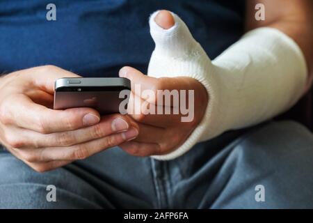 Mann mit Gips auf gebrochene Hand gegossen, gebrochenen Daumen, gebrochenes Handgelenk mittels Smartphone