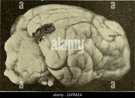 . Physiologische und Klinische Untersuchungen über das Gehirn, gesammelte Abhandlungen. Abb. 167.. Abb. 168. - 398 13 eol&gt; ein, uiidL clitimsr 103 104. Stockfoto