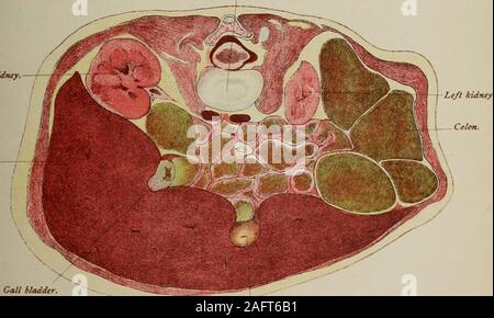 . Handbuch der pränatale Pathologie und Hygiene: der Fötus. Platte vi Knorpel zwischen den Zweiten und Dritten lendenwirbel Zertebrae. ght Niere.. Ich blase. Stockfoto