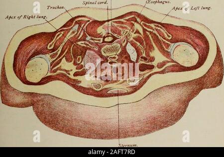 . Handbuch der pränatale Pathologie und Hygiene: der Fötus. Platte u oberen Teil der Körper der ersten Brustwirbel. Spimtl Kabel. Apex o/rechten Lungenflügel. Apex o/linken Lungenflügel.. Stockfoto