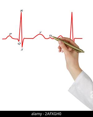 Zeichnung EKG Stockfoto