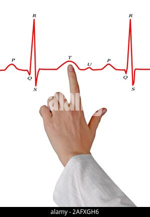 Zeichnung EKG Stockfoto