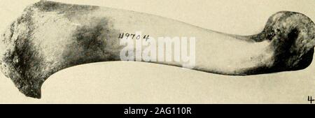 . Smithsonian sonstige Sammlungen. Rechts humerus von vier Exemplare der Rocky Mountain sheep (Abb. 2, Art der NcmoHurdus palnicri Cragin). SMITHSONIAN SONSTIGE SAMMLUNGEN VOLUAIE 82, Nummer 15 DREI KLEINE SAMMLUNGEN VON MAMMALSFROM HISFANIOLA (mit zwei Platten) BYGERRIT S. MILLER, JR. Kurator, Abteilung der Säugetiere, US National Mviseum (Veröffentlichung: 3109) Guy von der Smithsonian Institution in Washington veröffentlicht Dezember 24, 1930 BALTIMORE, MD., U. S. A., drei kleine SAMMLUNGEN VON SÄUGETIEREN FROMLIISPANIOLA von Gerrit S. MILLER, JR. Kurator der Abteilung für Säugetiere, u. s. National Museum (W Stockfoto