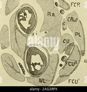 . Das amerikanische Journal der Anatomie. ^ Die Fusion der maincondylo-ulnar Sehne mit den anderen vier Teile der flexor com-Munis. Später die oberflächlichen condylo-ulnar Sehne teilt sich in drei J. Playfair McMurrich 197 slip 5, Avhich Pass, um die zweite, dritte und vierte Stelle und sind drei der Sehnen der flexor digitonim sublimis. Auf die Ermittlung der pahnaris lohgns distal Es ist gefunden auf itsdeep Oberfläche zu entwickeln; eine schlanke Sehne, vertreten durch den schattigen Teil inFig. 5 Und gegen das Handgelenk der Rest der Muskel in einem flachen zehn Pässe - Don, die in der Palmaren fascia verloren geht. Die Stockfoto