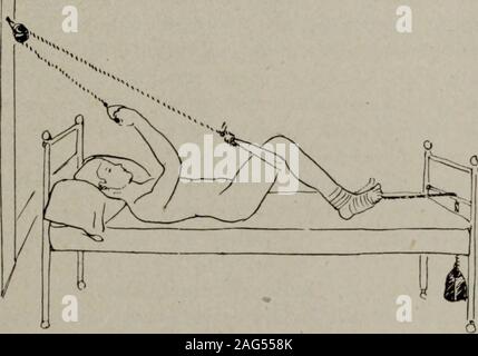 . Ein Handbuch für Heilgymnastik und Massage, für den Einsatz von Ärzten, Studenten und Masseuren entwickelt. Abb. 15.- Aktive und passive Beugung der Knie. häufig als jedes andere System. Zanders Apparate, die mehr sind als 70 an der Zahl, in Übungen mit Seilen und Seilrollen 53 diejenigen für aktive ohmsche Übung unterteilt sind und für passive und für aktive - passive Bewegung, für bestimmte massage Manipulationen, wie asfriction, Hacking und Vibration, und eine Reihe von specialapparatus für die Behandlung der seitliche Krümmung. Der Apparat für die aktive Ausübung sind so konstruiert, dass sie selbständig nach demlösen Princ Stockfoto