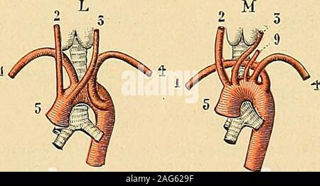 . "Traité d'anatomie humaine: beschreibende Anatomie, Histologie, Développement. Abb. 657. Variété? Dorigine des troncs sus-aorliqucs chez Lhomme (daprès Tiedmakk). 1, sous-clavicre diôHe. - 2. carotide primitive Droite. - 3, carotide primitive gauche. - 4 sous-clavière gauche. -6, tronc brachio-céphaliquc. - 7. tronc innominé. - S. vertébrale Droite. - 9, vertébrale gauche. sincurvait en arrière, descendait Le Long de la Colonne vertébrale et se terminait par lartèreiliaque primitive Droite; Quanta laorte postérieure, Elle fournissait le Tronc brachio-céphaliqueet Les artères carotide Primiti Stockfoto