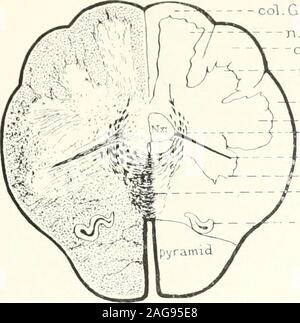 . Ein Atlas der Differentialdiagnose von Erkrankungen des Nervensystems (mit einem physiologischen Einführung); analytische und semeiological neurologische Charts. - N soli tar. - V. Spirale rt-Subst. gelat. -- N. ambig.dir cerebel Tr (flechsig) - ant. Die seitliche Tr. (Gowers)-t arcuatefibers Abb. 21 Schematischer Querschnitt durch die medulla, etwa in der Nähe der Mitte. Siehe 1290-1, 1321-4-94, 1401-8. 254. col. Klicken Sie^l n. gracilisCol. Biarda.chn. Cuneatus - SPINALE V-- Subst. gelat,. TTit. arcuatefr. - Ant. Viorn - lemniscus - Olivenöl Abb. 22 Querschnitt medulla gerade über Motor decussation ein Stockfoto