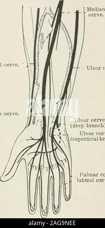 . Medizinische und chirurgische Therapie. Rudiiil Nerv. Uliiiir Nerv. - F Ulnaris. . Mittlere Nerv. Ulnaris (Tiefe). ^^Ulnaren nerveCsuperlicial Zweig) [. Jalraar col - seitliche Nerv. Abb. 10. - die Nerven des Arms. Abb. 17. - die Nerven des Unterarms und der Hand. In den Arm folgt tlie interne Grenze der Bizeps, der itback aj^ anticus iiinst der Positionen. Es gibt keine Muskeln auf itsinner Seite, es]) ecially in]) ersons, deren Muskeln nicht welldevelo sind]) e^l. Diese innere Seite entspricht der A. brachialis aponeurosisand Haut. An der Biegung der Winkelstück der mittleren Nervs verlässt den brachialartery und Stockfoto