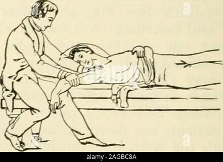 . Die moderne Chirurgie, allgemeine und operativen. Abb. 462.- Reduktion der Schulter - gelenkluxation durch das Knie in theaxilla CCooper).. Abb. 463.- Reduktion auf der Schulter - Gemeinsame dislocationby nach oben e. xtension CCooper). Lage, Praxis schnitt. In einigen Fällen nach der Inzision der Kopf des bonecan gezogen und in die richtige Position geschoben werden. In anderen Fällen der Kopf muss reseziert werden. Nach der Reduzierung eines alten Dislokation sichern für drei Wochen, und beginpassive Bewegung nach sieben Tagen. Wenn eine Verschiebung von einer Fraktur des Humerus kompliziert ist, versuchen Sie, thehead des Knochens gegenüber dem Gemeinsamen zu ziehen. Dies kann pos Stockfoto