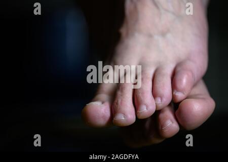 Nahaufnahme von shamed Frau verstecken Fußpilz Infektion Ihres altlete. Stinkende Füße weaty Durchführung einer ansteckenden Krankheit Stockfoto