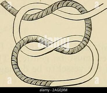 . Die moderne Chirurgie, allgemeine und operativen. Abb. 236.- Methode des Bindens Square oder Riff-Knoten. Abb. 237.- Methode der Oma - Knoten binden. Stockfoto