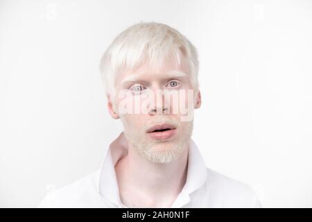 Porträt von einem Albino Mann im Studio t-shirt bekleidet auf einem weißen Hintergrund isoliert. Abnormale Abweichungen. ungewöhnliche Erscheinung. Haut. Störung Stockfoto