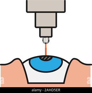 Laser-augenchirurgie Farbe Symbol. Medizinische Augenheilkunde. Augenlaser. Isolierte Vector Illustration Stock Vektor