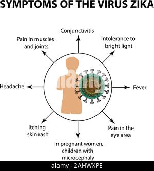 Symptome des Virus Zika. Infografiken. Vector Illustration auf isolierte Hintergrund Stock Vektor