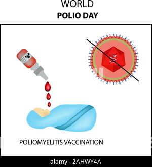 Impfungen gegen Kinderlähmung. World Polio Day. Die oralen Polio-Impfstoff OPV. Fällt. Infografiken. Vector Illustration Stock Vektor