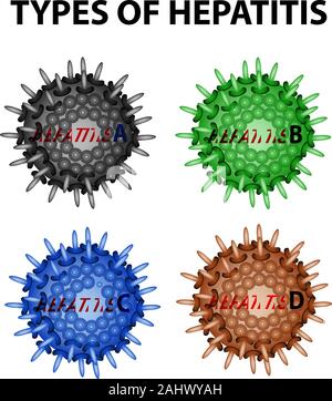 Arten von Hepatitis. Die Viren der Hepatitis A, B, C, D. Infografiken. Vector Illustration auf isolierte Hintergrund. Stock Vektor